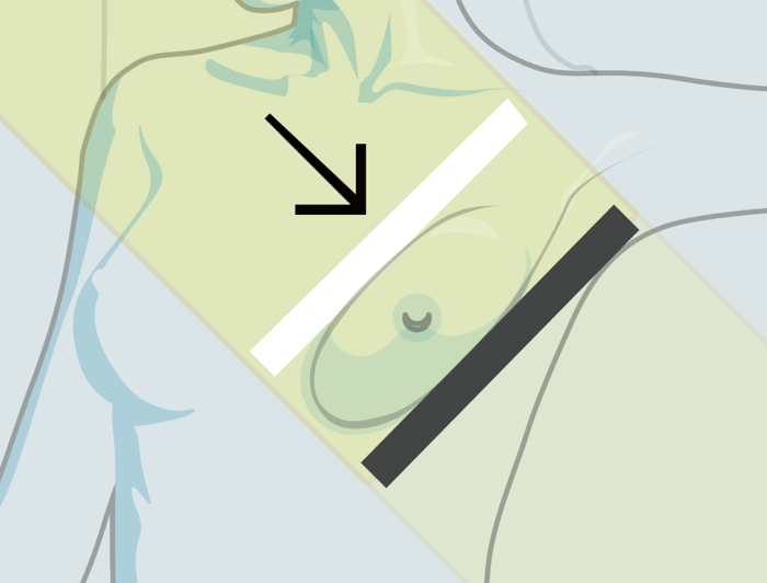 Smart Positioning Indicator