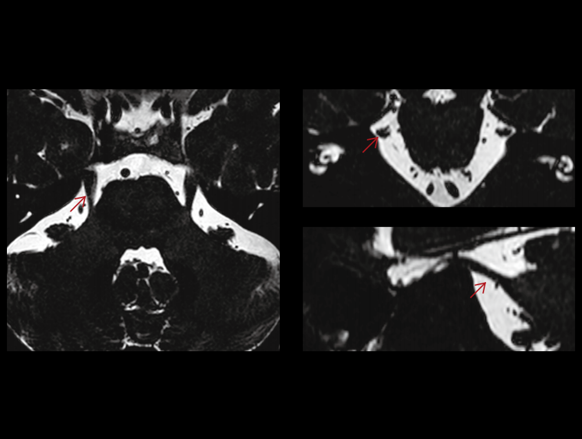 Trigeminal nerve imaging with comparisons