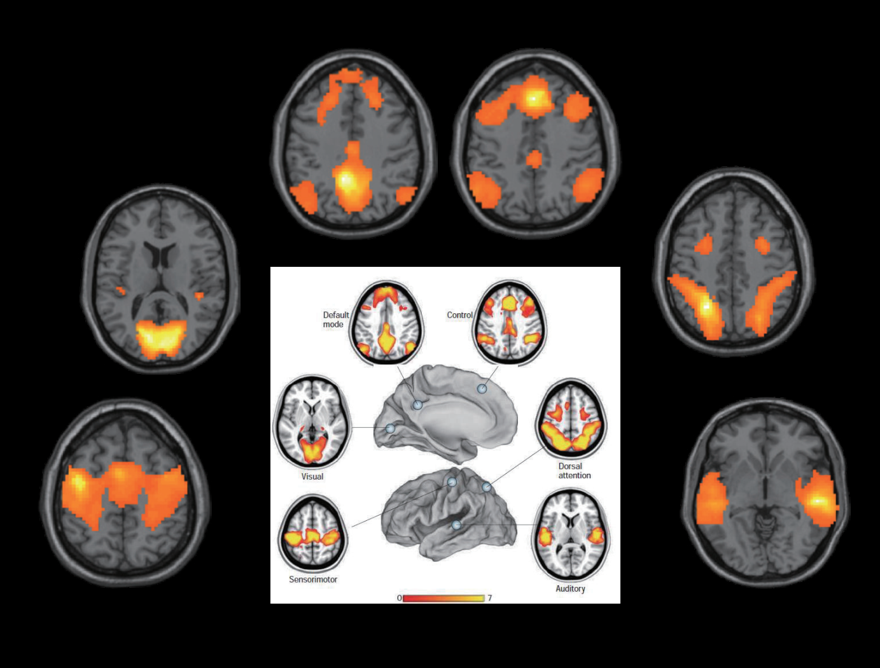 Resting-state fMRI 
